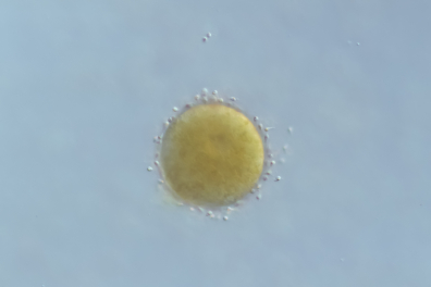 Fucus - Fécondation d'une oosphère par des anthérozoïdes x70